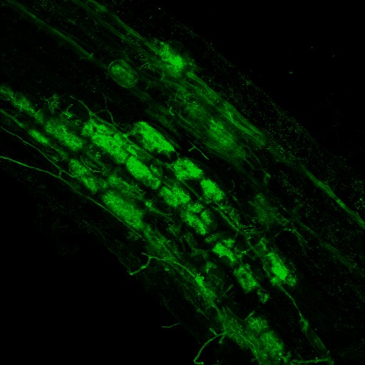 Arbuscular mycorrhizal fungi